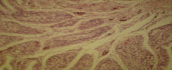 Diagnosis of salpingitis in female broilers with mycotoxicosis - Image 3