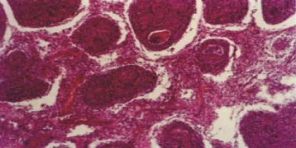 Occurrence of infectious bursal disease after vaccination with a low-passage attenuated virus - Image 4
