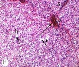 Protective effect of antioxidant medicinal herbs, Rosemary and Parsley, on subacute aflatoxicosis in Oreochromis niloticus - Image 8