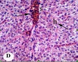 Protective effect of antioxidant medicinal herbs, Rosemary and Parsley, on subacute aflatoxicosis in Oreochromis niloticus - Image 6