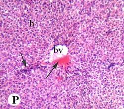 Protective effect of antioxidant medicinal herbs, Rosemary and Parsley, on subacute aflatoxicosis in Oreochromis niloticus - Image 18