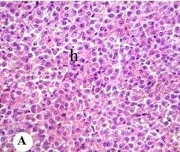 Protective effect of antioxidant medicinal herbs, Rosemary and Parsley, on subacute aflatoxicosis in Oreochromis niloticus - Image 3