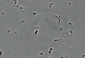Allisonella histaminiformans, a novel histamine-producing bacterium that may play a role in rumen disorders and bovine laminitis - Image 1