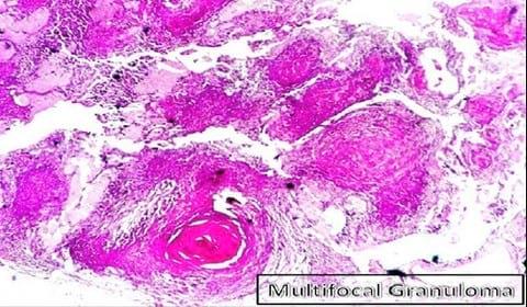 First Record of Mycobacteriosis in the Dusky Grouper (Epinephelus Marginatus) From Mediterranean Coastal Shores of Marsa Matrouh Province, Egypt - Image 3