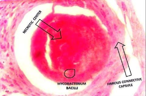 First Record of Mycobacteriosis in the Dusky Grouper (Epinephelus Marginatus) From Mediterranean Coastal Shores of Marsa Matrouh Province, Egypt - Image 5