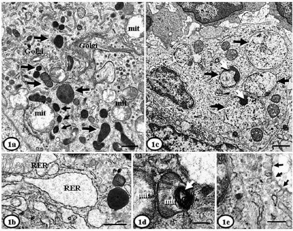 Ultrastructural Findings in Lymph Nodes from Pigs Suffering from Naturally Occurring Postweaning Multisystemic Wasting Syndrome - Image 3