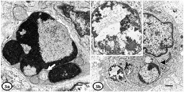 Ultrastructural Findings in Lymph Nodes from Pigs Suffering from Naturally Occurring Postweaning Multisystemic Wasting Syndrome - Image 5