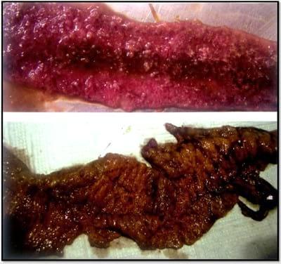 Necrotic Enteritis in Poultry- A Serious Profit Killer - Image 2