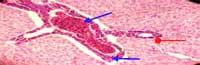 Nutritious Attempts to Detoxify Aflatoxic Diets of Tilapia Fish - Image 12