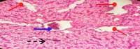 Nutritious Attempts to Detoxify Aflatoxic Diets of Tilapia Fish - Image 15