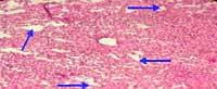Nutritious Attempts to Detoxify Aflatoxic Diets of Tilapia Fish - Image 19