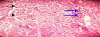 Nutritious Attempts to Detoxify Aflatoxic Diets of Tilapia Fish - Image 30