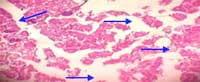 Nutritious Attempts to Detoxify Aflatoxic Diets of Tilapia Fish - Image 33