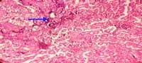 Nutritious Attempts to Detoxify Aflatoxic Diets of Tilapia Fish - Image 35