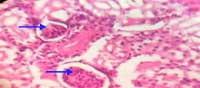 Nutritious Attempts to Detoxify Aflatoxic Diets of Tilapia Fish - Image 37