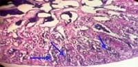 Nutritious Attempts to Detoxify Aflatoxic Diets of Tilapia Fish - Image 67