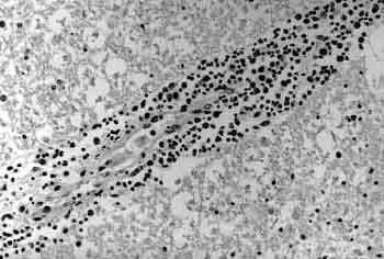 Demonstration of Listeria monocytogenes by Immunohistochemistry in Formalin-Fixed Brain Tissues from Natural Cases of Ovine and Bovine Encephalitis - Image 4