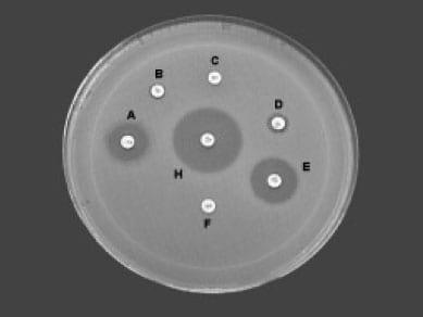 Effect of hen age, Bio-Mos and Flavomycin on susceptibility of turkey poults to oral Escherichia coli challenge - Image 2