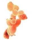 Selenium yeast production: a fully controlled fermentation process - Image 1