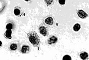 Immunological factors in Black Tiger shrimp, Penaeus monodon, Fabricius - Image 1