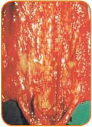 Urinary Tract Infection (UTI) in Sows - A review - Image 3