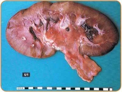 Urinary Tract Infection (UTI) in Sows - A review - Image 4