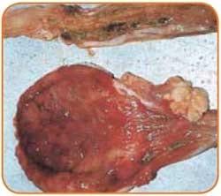 Urinary Tract Infection (UTI) in Sows - A review - Image 5