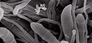 Interpretation of the results of mycotoxin's analysis in feed - Image 2