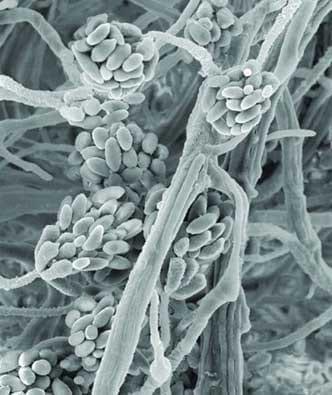 Interpretation of the results of mycotoxin's analysis in feed - Image 28