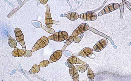 Interpretation of the results of mycotoxin's analysis in feed - Image 30