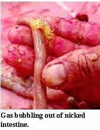 A Picture Guide of Chicken Feed Withdrawal - Image 12