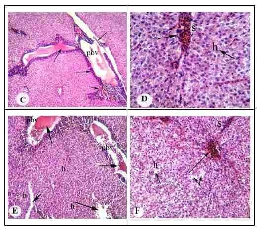 Protective effect of antioxidant medicinal herbs, Rosemary and Parsley, on subacute aflatoxicosis in Oreochromis niloticus - Image 4