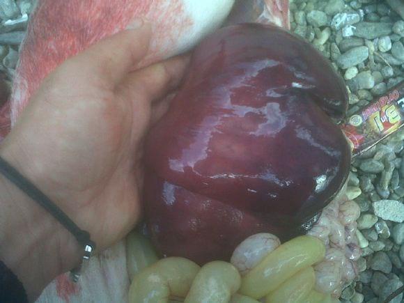 Hepatomegaly and congestion