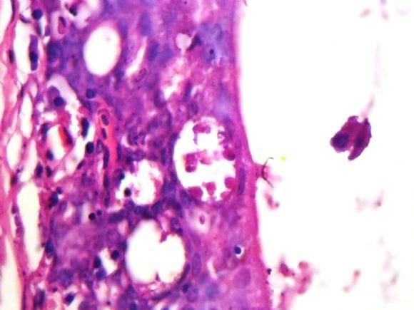 Is this Infectious Laryngotracheitis (ILT) ?