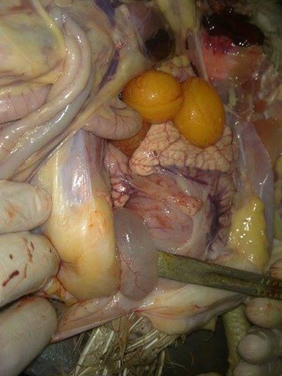 Cystic Right Oviduct