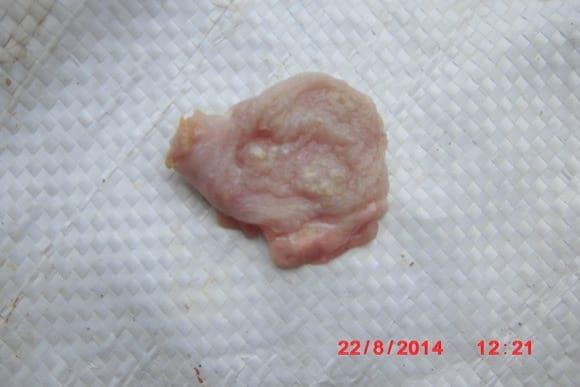 Candidiasis in crop
