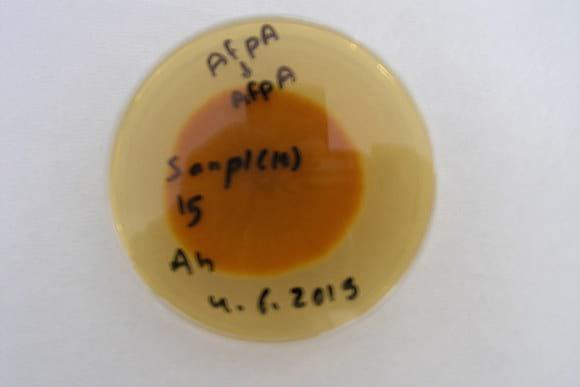 Aspergillus flavus