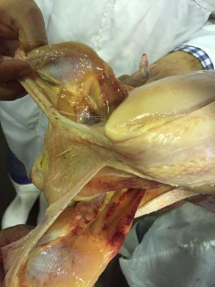 Petechiae in the thigh muscle