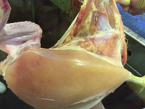 Petechiae of the thigh