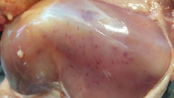 Petechiae of pectoral muscle