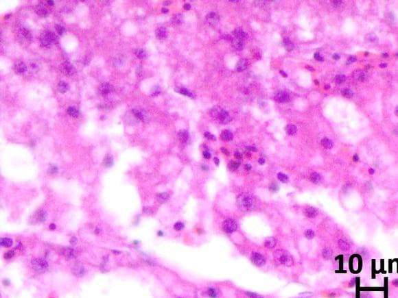 liver problem in cobb 400 y broiler species
