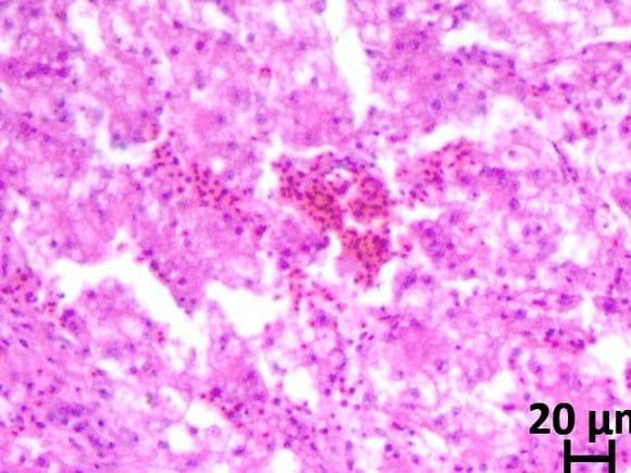 liver problem in cobb 400 y broiler