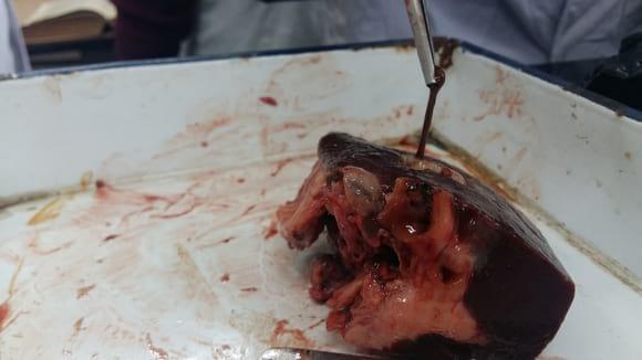 Fascioliasis in the liver of cattle