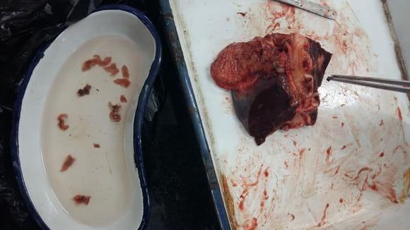 Fascioliasis in the liver of cattle