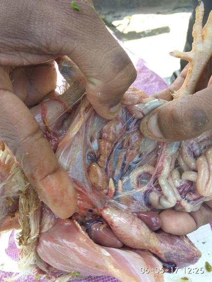 Kidney Swelling