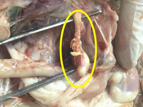 Salpingitis