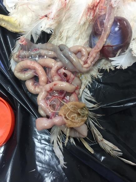 Ascariasis