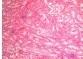 Ochratoxicosis