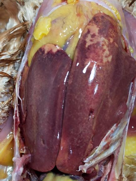Liver changes