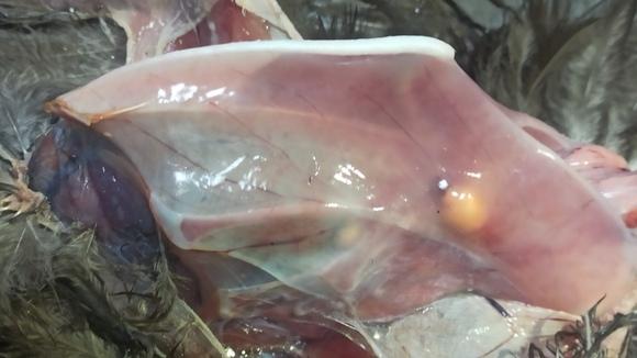 Tumour in chest